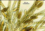 Feldmannia irregularis4